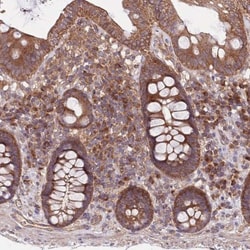 MFNG Antibody, Novus Biologicals 25 &mu;L, Unlabeled:Antibodies, Polyclonal